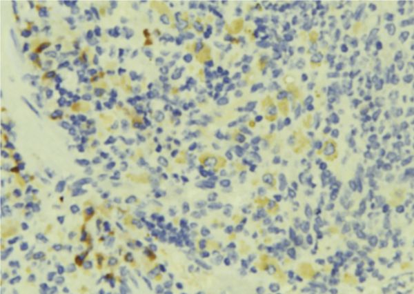 TMSB4X / Thymosin Beta-4 Antibody - 1:100 staining human lymph tissue by IHC-P. The sample was formaldehyde fixed and a heat mediated antigen retrieval step in citrate buffer was performed. The sample was then blocked and incubated with the antibody for 1.5 hours at 22°C. An HRP conjugated goat anti-rabbit antibody was used as the secondary.