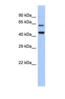 TMTC2 Antibody - Western blot of Human HeLa. TMTC2 antibody dilution 1.0 ug/ml.  This image was taken for the unconjugated form of this product. Other forms have not been tested.