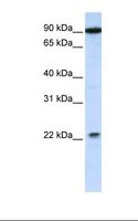 TMTC4 Antibody - 721_B cell lysate. Antibody concentration: 1.0 ug/ml. Gel concentration: 12%.  This image was taken for the unconjugated form of this product. Other forms have not been tested.