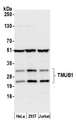 TMUB1 Antibody - Detection of human TMUB1 by western blot. Samples: Whole cell lysate (50 µg) from HeLa, HEK293T, and Jurkat cells prepared using NETN lysis buffer. Antibody: Affinity purified rabbit anti-TMUB1 antibody used for WB at 1:1000. Detection: Chemiluminescence with an exposure time of 10 seconds.