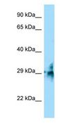 TMUB2 Antibody - TMUB2 antibody Western Blot of Fetal Skin.  This image was taken for the unconjugated form of this product. Other forms have not been tested.