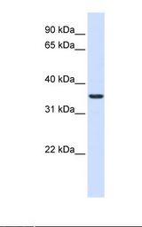 TMX2 / TXNDC14 Antibody - Fetal liver lysate. Antibody concentration: 1.0 ug/ml. Gel concentration: 12%.  This image was taken for the unconjugated form of this product. Other forms have not been tested.