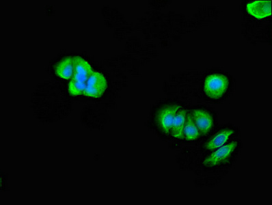 TMX2 / TXNDC14 Antibody - Immunofluorescent analysis of MCF-7 cells using TMX2 Antibody at dilution of 1:100 and Alexa Fluor 488-congugated AffiniPure Goat Anti-Rabbit IgG(H+L)