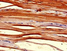 TMX2 / TXNDC14 Antibody - Immunohistochemistry of paraffin-embedded human skeletal muscle tissue using TMX2 Antibody at dilution of 1:100