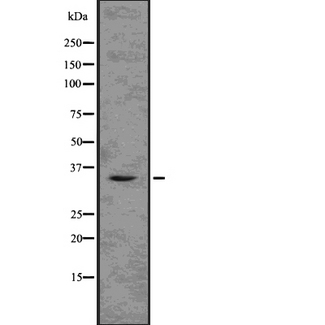 TMX2 / TXNDC14 Antibody - Western blot analysis of TMX2 using K562 whole lysates.