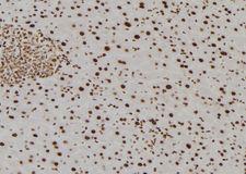 TMX2 / TXNDC14 Antibody - 1:100 staining mouse liver tissue by IHC-P. The sample was formaldehyde fixed and a heat mediated antigen retrieval step in citrate buffer was performed. The sample was then blocked and incubated with the antibody for 1.5 hours at 22°C. An HRP conjugated goat anti-rabbit antibody was used as the secondary.