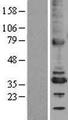TMX2 / TXNDC14 Protein - Western validation with an anti-DDK antibody * L: Control HEK293 lysate R: Over-expression lysate
