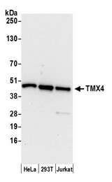 TMX4 Antibody - Detection of human TMX4 by western blot. Samples: Whole cell lysate (15 µg) from HeLa, HEK293T, and Jurkat cells prepared using NETN lysis buffer. Antibody: Affinity purified rabbit anti-TMX4 antibody used for WB at 1:1000. Detection: Chemiluminescence with an exposure time of 10 seconds.