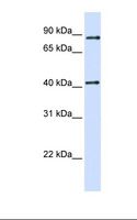 TMX4 Antibody - 293T cell lysate. Antibody concentration: 1.0 ug/ml. Gel concentration: 12%.  This image was taken for the unconjugated form of this product. Other forms have not been tested.