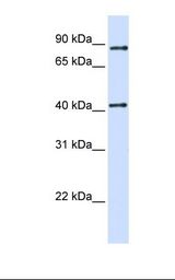 TMX4 Antibody - 293T cell lysate. Antibody concentration: 1.0 ug/ml. Gel concentration: 12%.  This image was taken for the unconjugated form of this product. Other forms have not been tested.