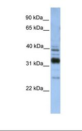 TMX4 Antibody - Fetal liver lysate. Antibody concentration: 1.0 ug/ml. Gel concentration: 12%.  This image was taken for the unconjugated form of this product. Other forms have not been tested.