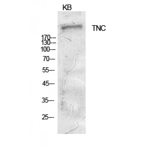 TNC / Tenascin C Antibody - Western blot of Tenascin-C antibody