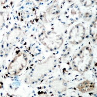 TNC / Tenascin C Antibody - Immunohistochemical analysis of Tenascin C staining in human kidney formalin fixed paraffin embedded tissue section. The section was pre-treated using heat mediated antigen retrieval with sodium citrate buffer (pH 6.0). The section was then incubated with the antibody at room temperature and detected using an HRP polymer system. DAB was used as the chromogen. The section was then counterstained with hematoxylin and mounted with DPX.