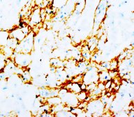 TNC / Tenascin C Antibody -  This image was taken for the unconjugated form of this product. Other forms have not been tested.