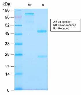 TNC / Tenascin C Antibody - SDS-PAGE Analysis Purified Tenascin C Rabbit Recombinant Monoclonal Antibody (TNC/2981R). Confirmation of Purity and Integrity of Antibody.