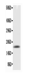 TNF Alpha Antibody - Western blot - Anti-TNF alpha Antibody
