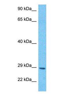 TNF Alpha Antibody - Western blot of TNFA Antibody with human MCF7 Whole Cell lysate.  This image was taken for the unconjugated form of this product. Other forms have not been tested.