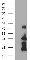 TNF Alpha Antibody - HEK293T cells were transfected with the pCMV6-ENTRY control (Left lane) or pCMV6-ENTRY TNF (Right lane) cDNA for 48 hrs and lysed. Equivalent amounts of cell lysates (5 ug per lane) were separated by SDS-PAGE and immunoblotted with anti-TNF.