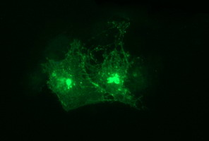 TNF Alpha Antibody - Anti-TNF mouse monoclonal antibody immunofluorescent staining of COS7 cells transiently transfected by pCMV6-ENTRY TNF.