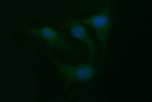 TNF Alpha Antibody - Immunofluorescent staining of HeLa cells using anti-TNF mouse monoclonal antibody.