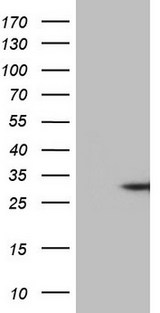 TNF Alpha Antibody - HEK293T cells were transfected with the pCMV6-ENTRY control. (Left lane) or pCMV6-ENTRY TNF. (Right lane) cDNA for 48 hrs and lysed. Equivalent amounts of cell lysates. (5 ug per lane) were separated by SDS-PAGE and immunoblotted with anti-TNF. (1:500)
