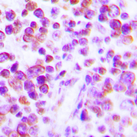 TNF Alpha Antibody - Immunohistochemical analysis of TNF alpha staining in human tonsil formalin fixed paraffin embedded tissue section. The section was pre-treated using heat mediated antigen retrieval with sodium citrate buffer (pH 6.0). The section was then incubated with the antibody at room temperature and detected using an HRP conjugated compact polymer system. DAB was used as the chromogen. The section was then counterstained with hematoxylin and mounted with DPX.