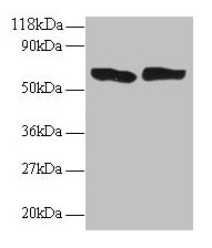 TNF Alpha Antibody - Western blot All lanes: Tumor necrosis factor antibody at 2/ml Lane 1: 293T whole cell lysate Lane 2: EC109 whole cell lysate Secondary Goat polyclonal to rabbit IgG at 1/15000 dilution Predicted band size: 26 kDa Observed band size: 60 kDa