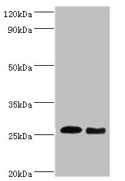 TNF Alpha Antibody - Western blot All lanes: Tumor necrosis factor antibody at dilution of 1: 1000 Lane 1: Tumor necrosis factor protein at 0.05µg Lane 2: Tumor necrosis factor protein at 0.5µg Secondary Goat polyclonal to rabbit IgG at 1/10000 dilution Predicted band size: 26 kDa Observed band size: 26 kDa