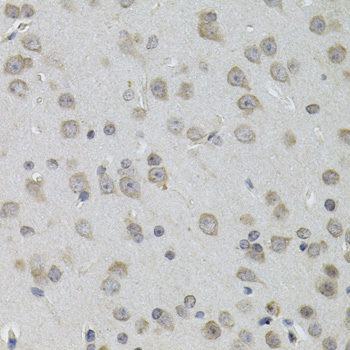 TNF Alpha Antibody - Immunohistochemistry of paraffin-embedded mouse brain tissue.