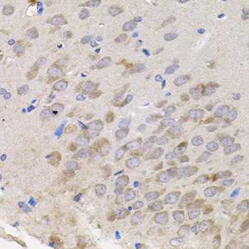 TNF Alpha Antibody - Immunohistochemistry of paraffin-embedded rat brain tissue.