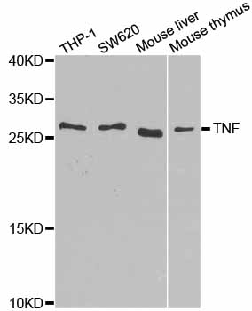 TNF Alpha Antibody - Western blot analysis of extracts of various cell lines, using TNF antibody at 1:1000 dilution. The secondary antibody used was an HRP Goat Anti-Rabbit IgG (H+L) at 1:10000 dilution. Lysates were loaded 25ug per lane and 3% nonfat dry milk in TBST was used for blocking. An ECL Kit was used for detection and the exposure time was 90s.