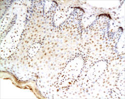 TNF Alpha Antibody - TNF-alpha staining in human skin. Paraffin-embedded human skin is stained with TNF-alpha Antibody used at a 1:100 dilution.