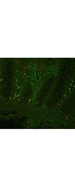 TNF Alpha Antibody - Anti-Human TNFa Antibody - Immunohistochemistry. Fluorescent immunohistochemistry showing staining of human colon by anti-TNF alpha (formalin/PFA-fixed paraffin-embedded sections). Samples were formaldehyde-fixed, then blocked in 10% serum for 2 hours at 20°C. The primary antibody was diluted 1:100 and incubated with the sample for 2 hours at 20°C. Alexa Fluor 680 goat polyclonal secondary antibody was used diluted 1:5000.