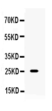 TNF Alpha Antibody - Western blot analysis of TNF alpha using anti-TNF alpha antibody. Electrophoresis was performed on a 5-20% SDS-PAGE gel at 70V (Stacking gel) / 90V (Resolving gel) for 2-3 hours. The sample well of each lane was loaded with 50ug of sample under reducing conditions. Lane 1: mouse thymus tissue lysates. After Electrophoresis, proteins were transferred to a Nitrocellulose membrane at 150mA for 50-90 minutes. Blocked the membrane with 5% Non-fat Milk/ TBS for 1.5 hour at RT. The membrane was incubated with rabbit anti-TNF alpha antigen affinity purified polyclonal antibody at 0.5 µg/mL overnight at 4°C, then washed with TBS-0.1% Tween 3 times with 5 minutes each and probed with a goat anti-rabbit IgG-HRP secondary antibody at a dilution of 1:10000 for 1.5 hour at RT. The signal is developed using an Enhanced Chemiluminescent detection (ECL) kit with Tanon 5200 system. A specific band was detected for TNF alpha at approximately 25KD. The expected band size for TNF alpha is at 25KD.