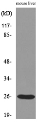 TNF Alpha Antibody - Western blot analysis of lysate from mouse liver cells, using TNF Antibody.