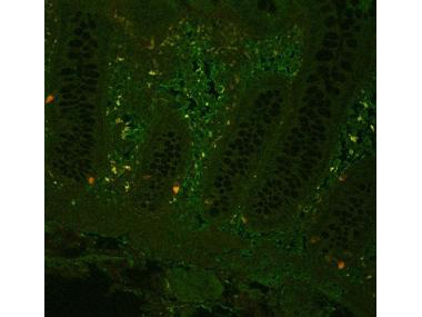 TNF Alpha Antibody - Fluorescent immunohistochemistry showing staining of human colon by Anti-TNF alpha (formalin/PFA-fixed paraffin-embedded sections). Samples were formaldehyde-fixed, then blocked in 10% serum for 2 hours at 20°C. The primary antibody was diluted 1:100 and incubated with the sample for 2 hours at 20°C. Alexa Fluor 680 goat polyclonal secondary antibody was used diluted 1:5000.