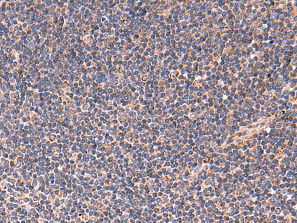 TNF Alpha Antibody - Immunohistochemistry of paraffin-embedded Human tonsil tissue  using TNF Polyclonal Antibody at dilution of 1:40(×200)