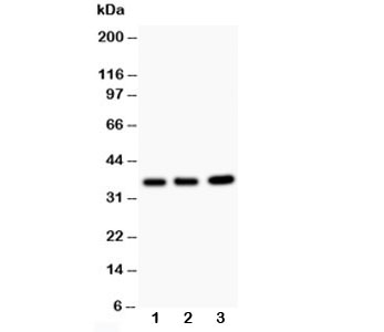 TNFAIP1 Antibody - Western blot testing of TNFAIP1 antibody and Lane 1: rat thymus; 2: HeLa; 3: COLO320; Predicted size: 36KD; Observed size: 36KD
