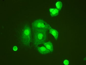 TNFAIP1 Antibody - IF/ICC testing of HeLa cells