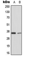 TNFAIP1 Antibody - Western blot analysis of TNFAIP1 expression in HUVEC (A); rat lung (B) whole cell lysates.