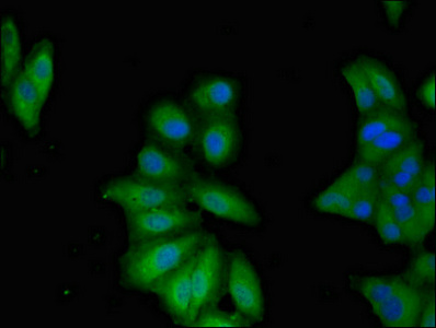 TNFAIP1 Antibody - Immunofluorescent analysis of Hela cells diluted at 1:100 and Alexa Fluor 488-congugated AffiniPure Goat Anti-Rabbit IgG(H+L)
