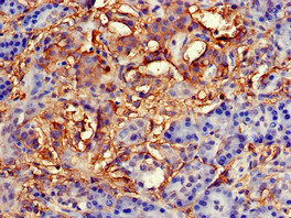TNFAIP1 Antibody - Immunohistochemistry of paraffin-embedded human pancreatic tissue at dilution of 1:100
