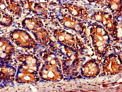 TNFAIP1 Antibody - Immunohistochemistry of paraffin-embedded human small intestine tissue at dilution of 1:100