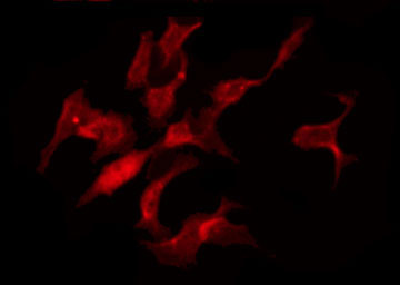 TNFAIP1 Antibody - Staining HuvEc cells by IF/ICC. The samples were fixed with PFA and permeabilized in 0.1% Triton X-100, then blocked in 10% serum for 45 min at 25°C. The primary antibody was diluted at 1:200 and incubated with the sample for 1 hour at 37°C. An Alexa Fluor 594 conjugated goat anti-rabbit IgG (H+L) Ab, diluted at 1/600, was used as the secondary antibody.