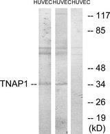 TNFAIP1 Antibody - Western blot analysis of extracts from HUVEC cells treated with PMA (125ng/ml, 30mins), and HUVEC cells treated with serum (20%, 30mins), using TNAP1 antibody.