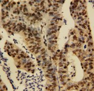 TNFAIP1 Antibody -  This image was taken for the unconjugated form of this product. Other forms have not been tested.