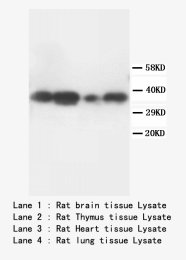 TNFAIP1 Antibody -  This image was taken for the unconjugated form of this product. Other forms have not been tested.