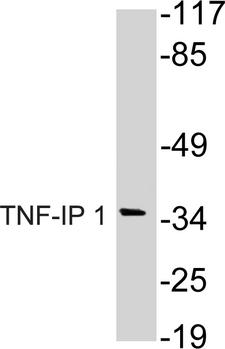 TNFAIP1 Antibody - Western blot of TNF-IP 1 (S122) pAb in extracts from HuvEc cells.
