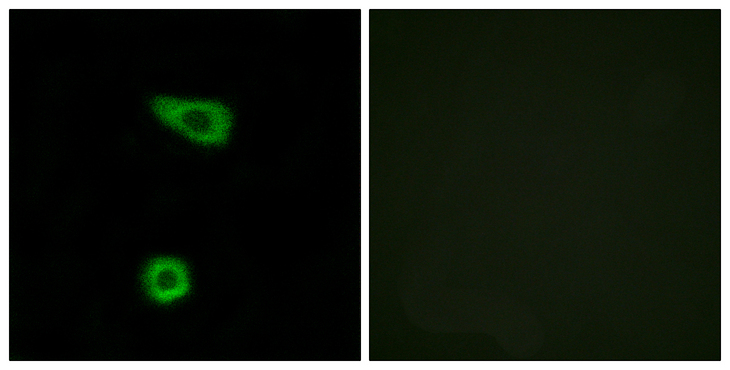 TNFAIP2 Antibody - Immunofluorescence analysis of HUVEC cells, using TNAP2 Antibody. The picture on the right is blocked with the synthesized peptide.