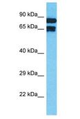 TNFAIP2 Antibody - TNFAIP2 antibody Western Blot of MCF7. Antibody dilution: 1 ug/ml.  This image was taken for the unconjugated form of this product. Other forms have not been tested.
